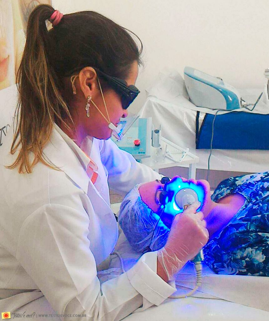 Tratamento para Acne com Equipamentos HTM Eletrônica Tratamento para Acne com Equipamentos HTM Eletrônica